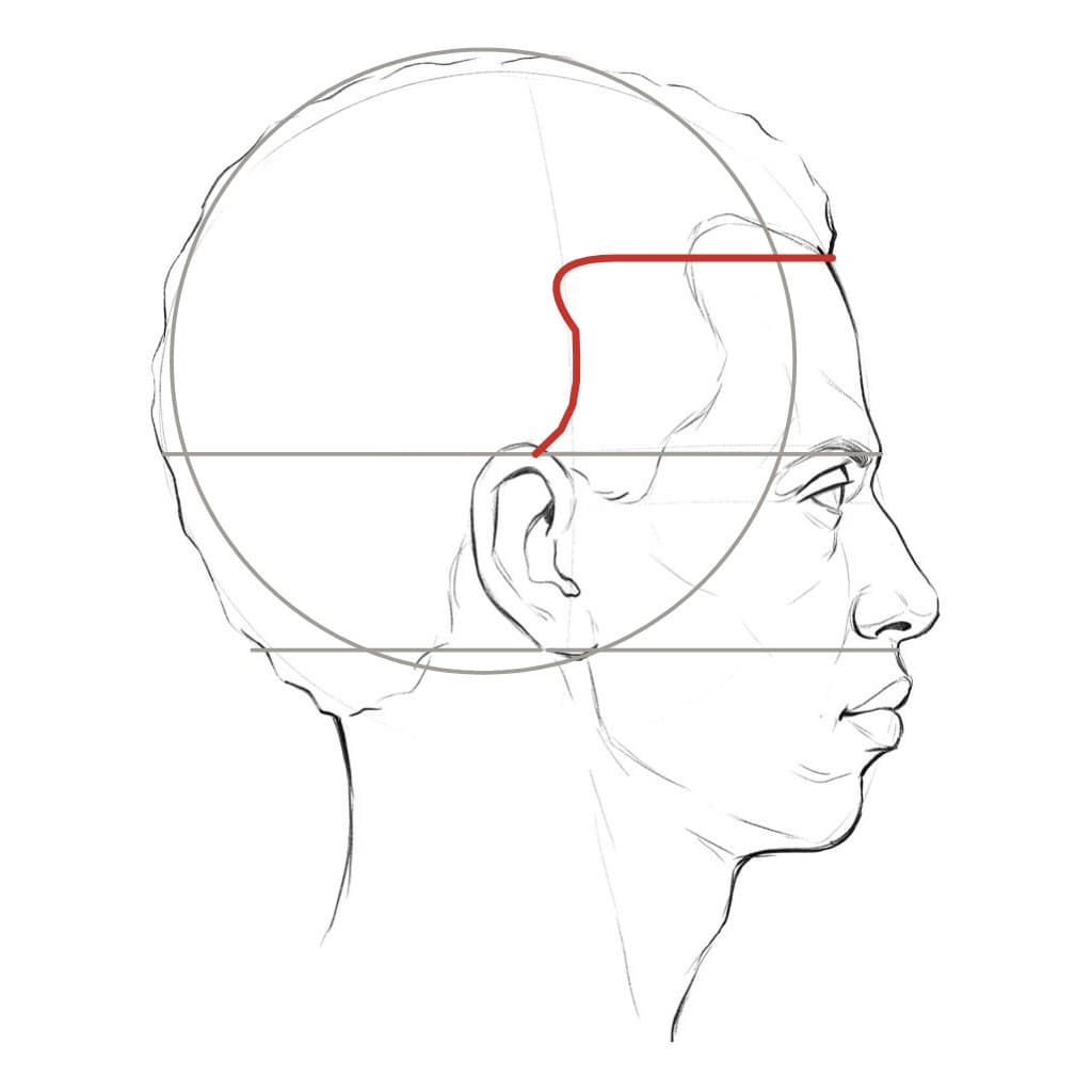 Line drawing of a head in profile with a red hairline coming back from the top of the forehead and turning down to the top of the ear