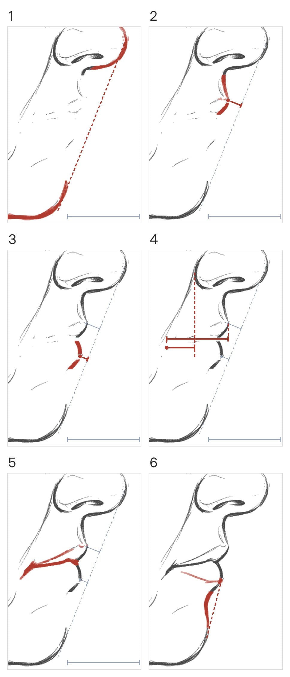 Six panels: the outline and nose-to-chin line, the upper lip, the lower lip, the corner, the two lines to it, the sag
